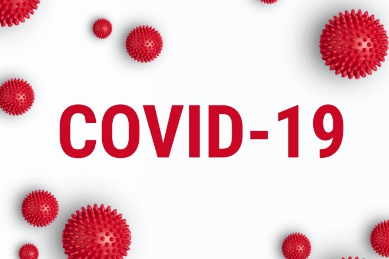 Covid-19: 5 practical tips for Property Developers to survive and thrive (part 1)